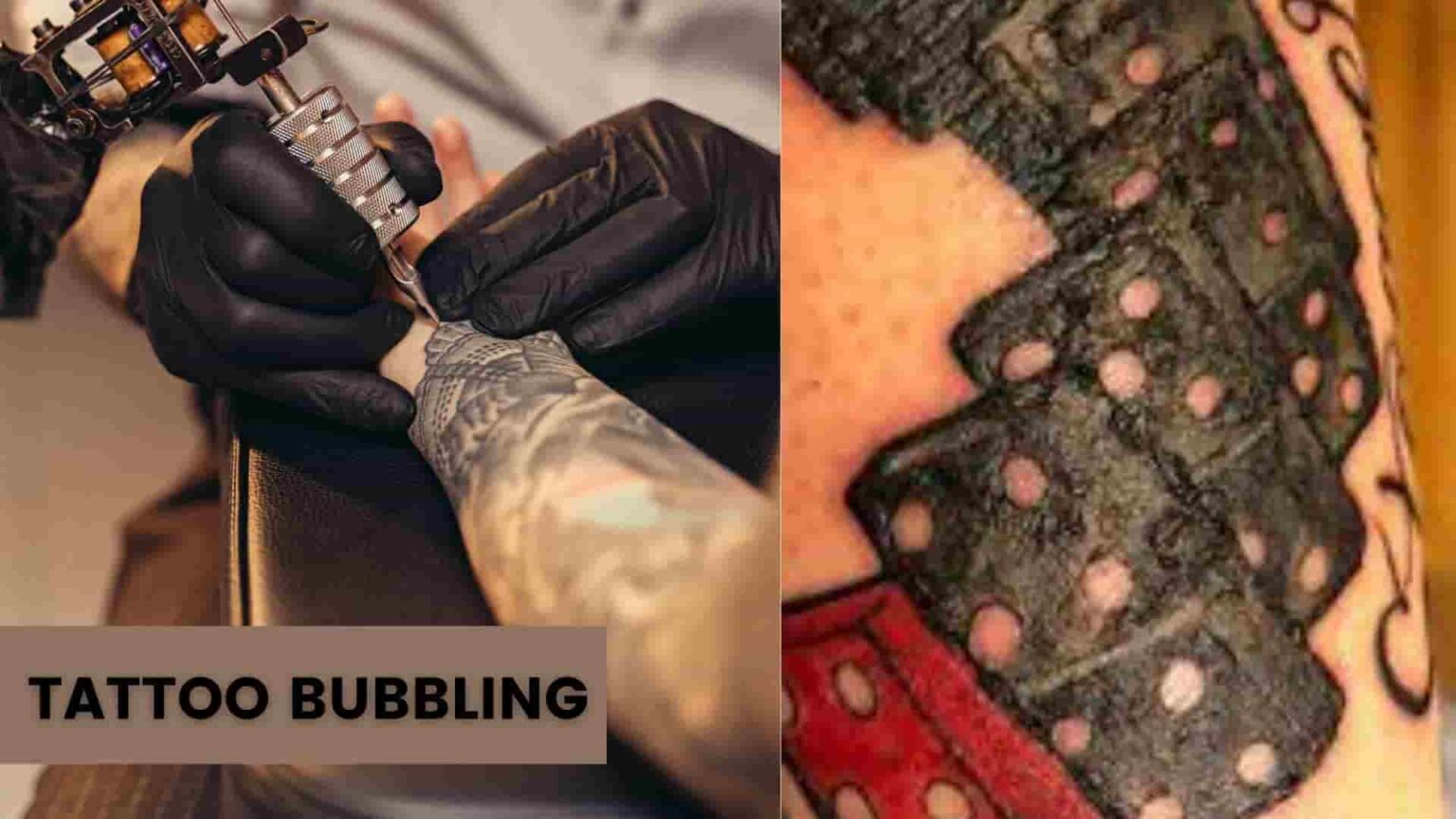 Tattoo Bubbling, What Cause Tattoo Bubble, Infection, Precaution